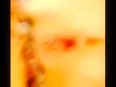 Thumb 20